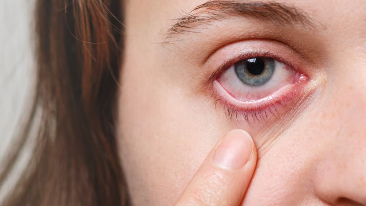 目に現れる高コレステロールの兆候に注意してください