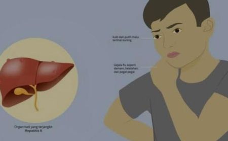 Antisipasi Hepatitis Akut, Dinkes Sleman Aktifkan Tim Surveilans