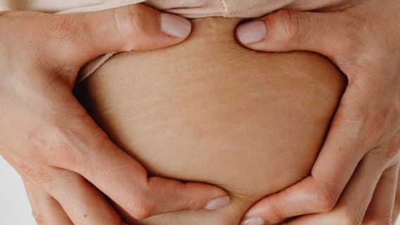 Banyak Dimiliki Namun Jarang Diketahui, Simak Penyebab dan Cara Menghilangkan Stretch Mark di Tubuh 