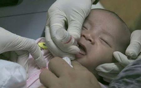 Temuan Anak 4 Tahun Terpapar Polio, 78.077 Balita di Purwakarta Jadi Sasaran Imunisasi