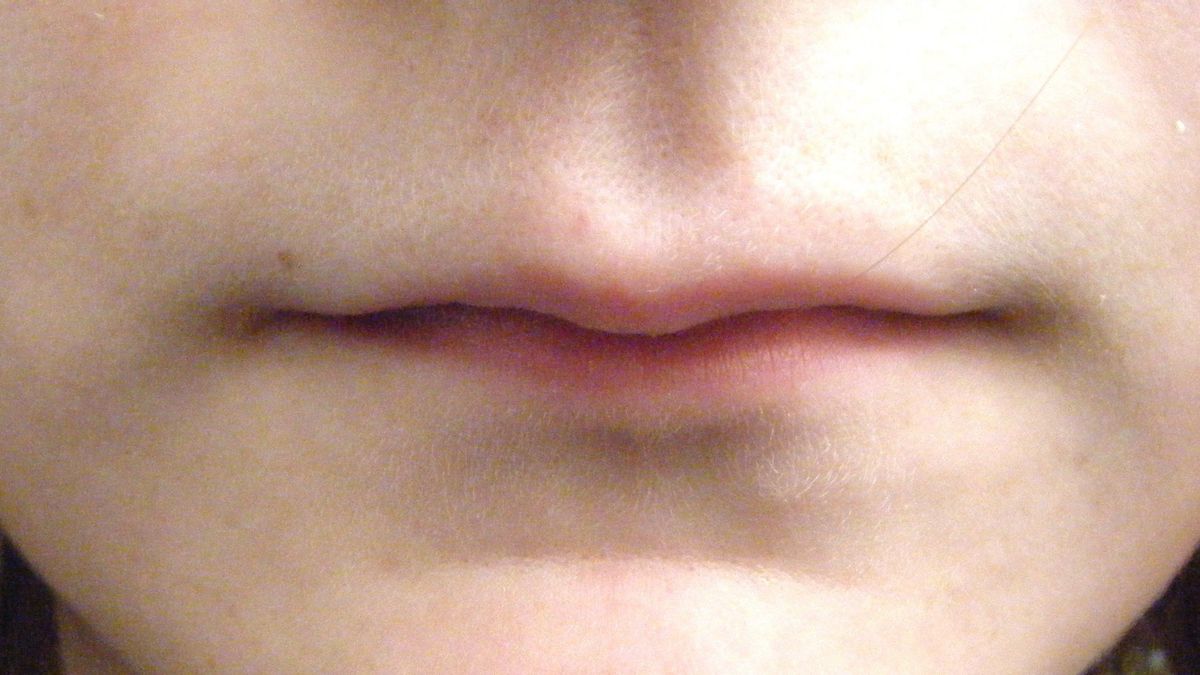 Penasaran Dengan Cara Menipiskan Bibir Permanen dalam 1 Hari? Begini Caranya