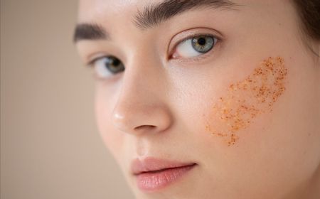 Melasma Tidak Berbahaya, Bintik-Bintik Hitam pada Kulit Wajah Ini Disebabkan Melanin Berlebih