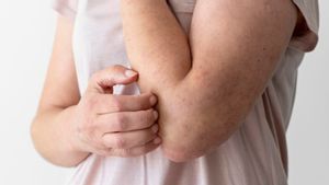 Mengapa Pengidap Diabetes Sering Merasa Gatal? Ini Penyebab dan Solusinya