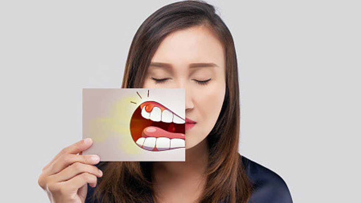 Cara Mencegah Gingivitis, Peradangan Gusi yang Disebabkan Penumpukan Plak