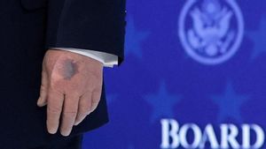 Penjelasan Medis Memar Tangan Trump, Efek Konsumsi Aspirin?   