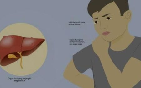 Orang Tua Harus Waspadai dan Kenali Gejala Dini Hepatitis Akut