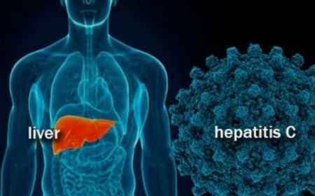 Epidemiolog Sebut Penyebaran Hepatitis Akut di Indonesia Lebih Rawan, Kenapa?