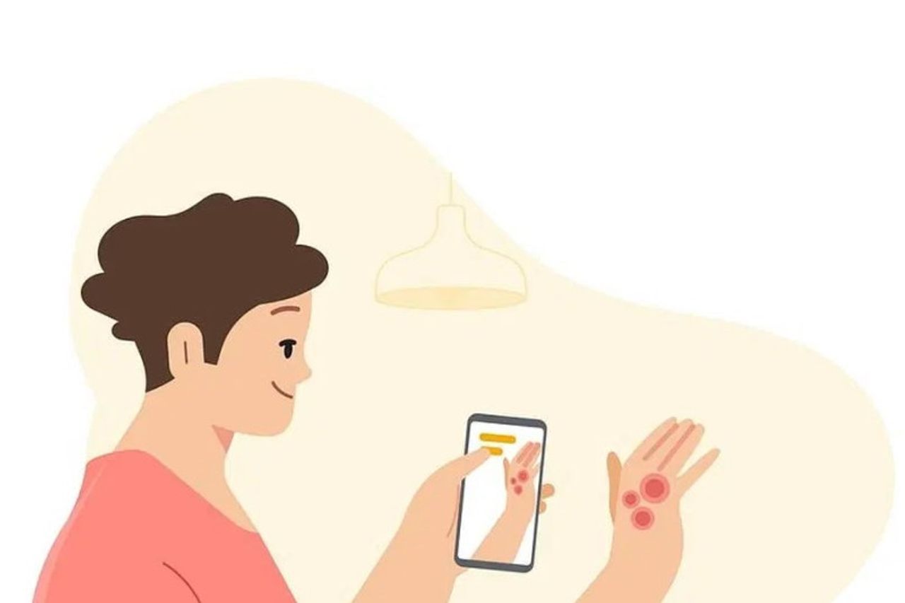 Googleは携帯電話のカメラを皮膚科用ツールにすることができます、それは皮膚障害を識別することができます!
