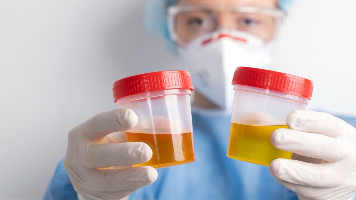 Mengejutkan! Bagian yang Berperan dalam Proses Pembentukan Urine Primer Ternyata Sangat Vital