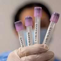 Seberapa Berbahaya Hantavirus di Indonesia?