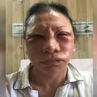 Kasus Hoaks Ratna Sarumpaet Rugikan Kubu Prabowo Subianto dalam Sejarah Hari Ini, 27 Oktober 2018