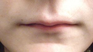 Penasaran Dengan Cara Menipiskan Bibir Permanen dalam 1 Hari? Begini Caranya