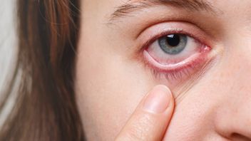 in est normal pour les conditions oculaires fréquentes? Voici l'explication du médecin