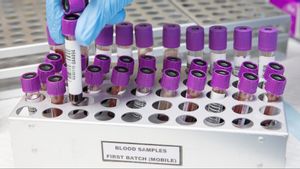 PMI-Eijkman Kembangkan Plasma Darah Bantu Penyembuhan COVID-19