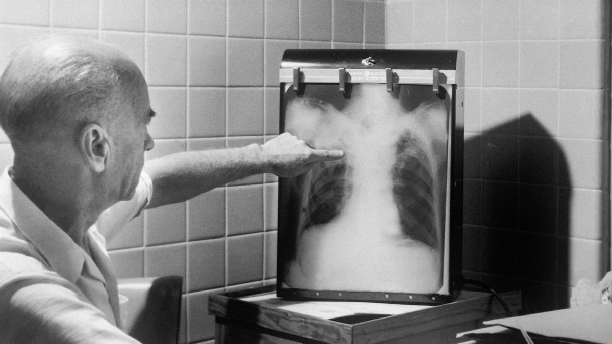 Apa Saja Ciri Penyakit TBC yang Sudah Parah? Ini Jawabannya