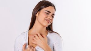 Pantangan Dermatitis Seboroik yang Perlu Diketahui
