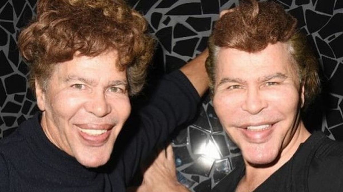 Handsome In The 70s, These TV Star Twins Are Called 'cat Man' After Undergoing A Series Of Plastic Surgeries