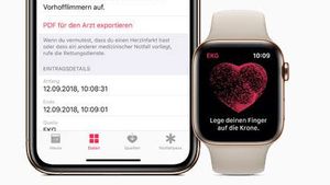 Peneliti Gunakan Apple Watch untuk Deteksi Stres, Hasilnya Akurat!