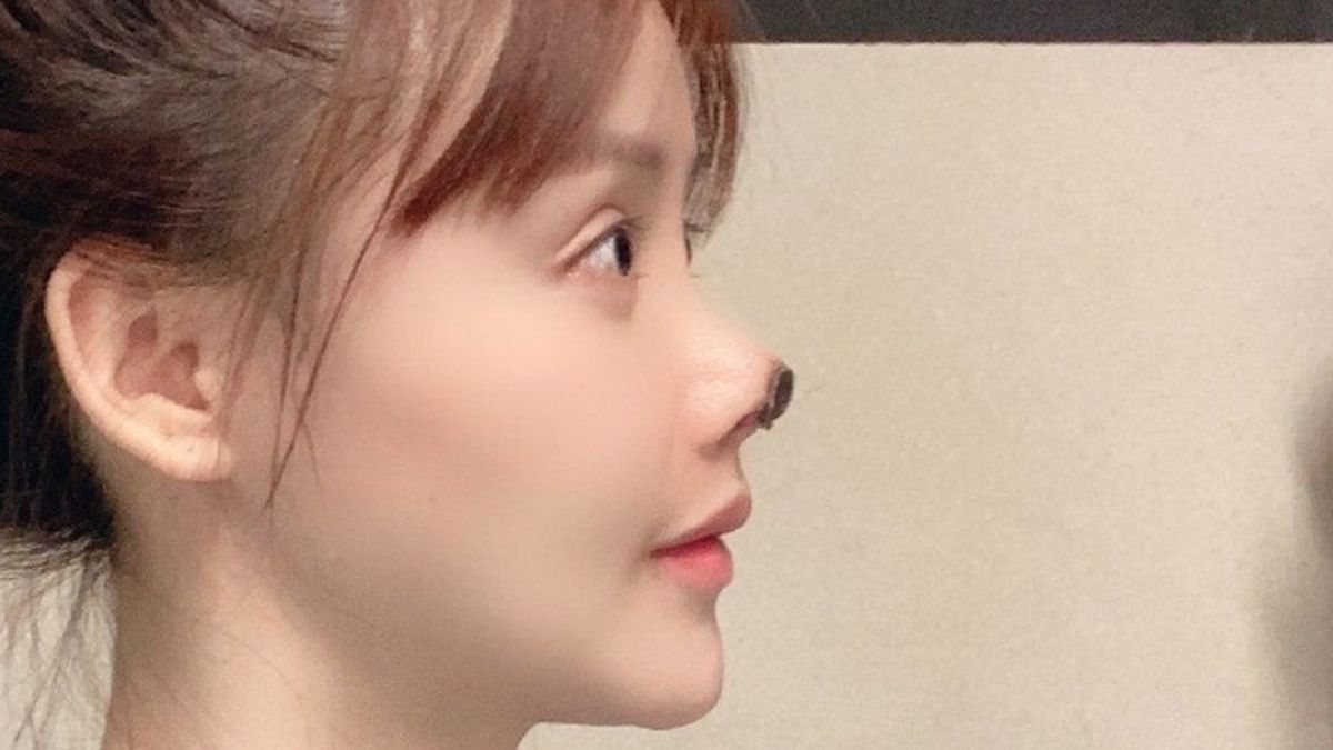 Failed Plastic Surgery, This Chinese Artist's Nose Is Black And Rotting