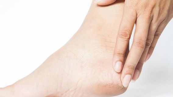 Tips Mengatasi Tumit Kaki Pecah-pecah dengan Bahan Alami 