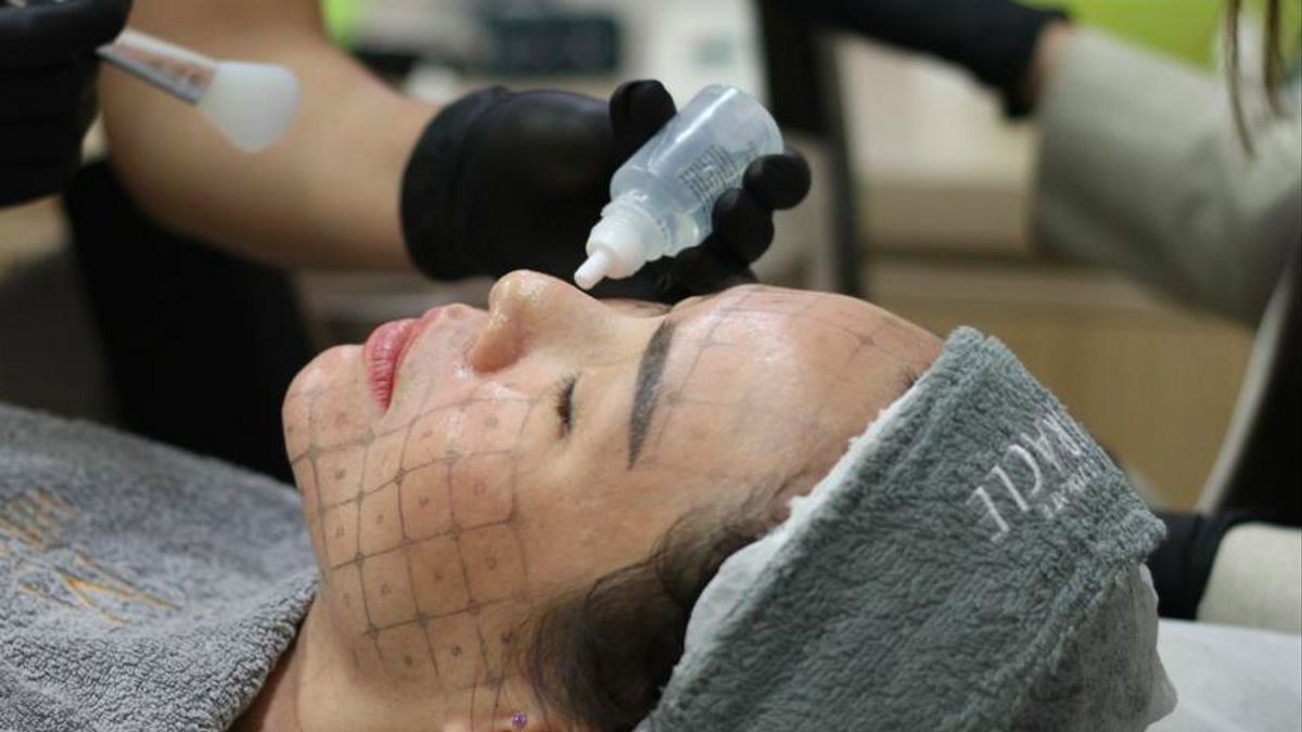 Plus que le lifting, voici la nouvelle tendance en matière de soins du visage plus naturels