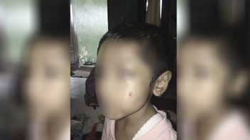 由于食物，5岁的女儿被继母虐待，受害者的父亲向警方报案