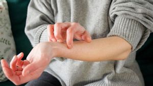 Kutu Air di Tangan Tak Kunjung Sembuh, Apa yang Harus Dilakukan?