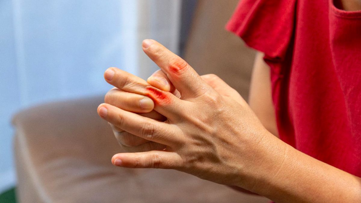 Banyak Orang Keliru soal Asam Urat, Ini Fakta Sebenarnya