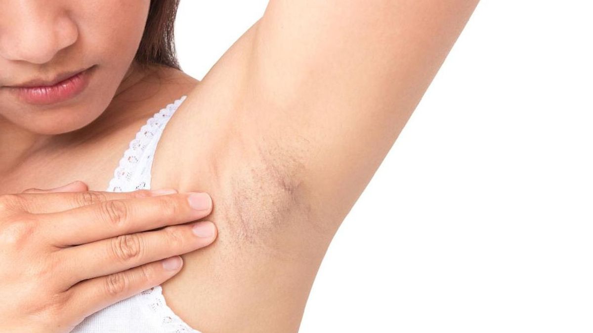 خصائص Benjolan في كيتياك التي ليست خطيرة ، لا تكن مباليا بها