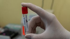 Varian Baru Virus Corona di Prancis Bisa Sembunyi dari Tes PCR, Lebih Mematikan atau Menular?