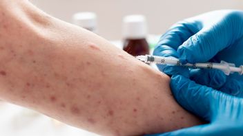 성인이 홍역 백신을 다시 맞아야 할까요? 이것은 완전한 설명입니다.