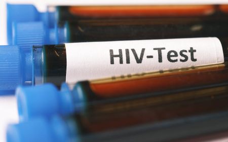 Tercatat Ada 76 Kasus HIV di Bengkulu Selama 2023