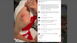 Kanibalism Incident In Euro 2024: Woman Bites Croatian Fans Because Of Jersey