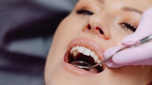 Waspada, Gigi Berlubang dan Sakit Gusi Dapat Tingkatkan Risiko Stroke