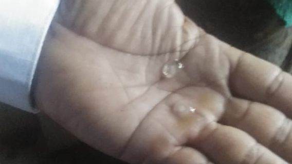 Hail Shocks the Residents In Bangli, Bali