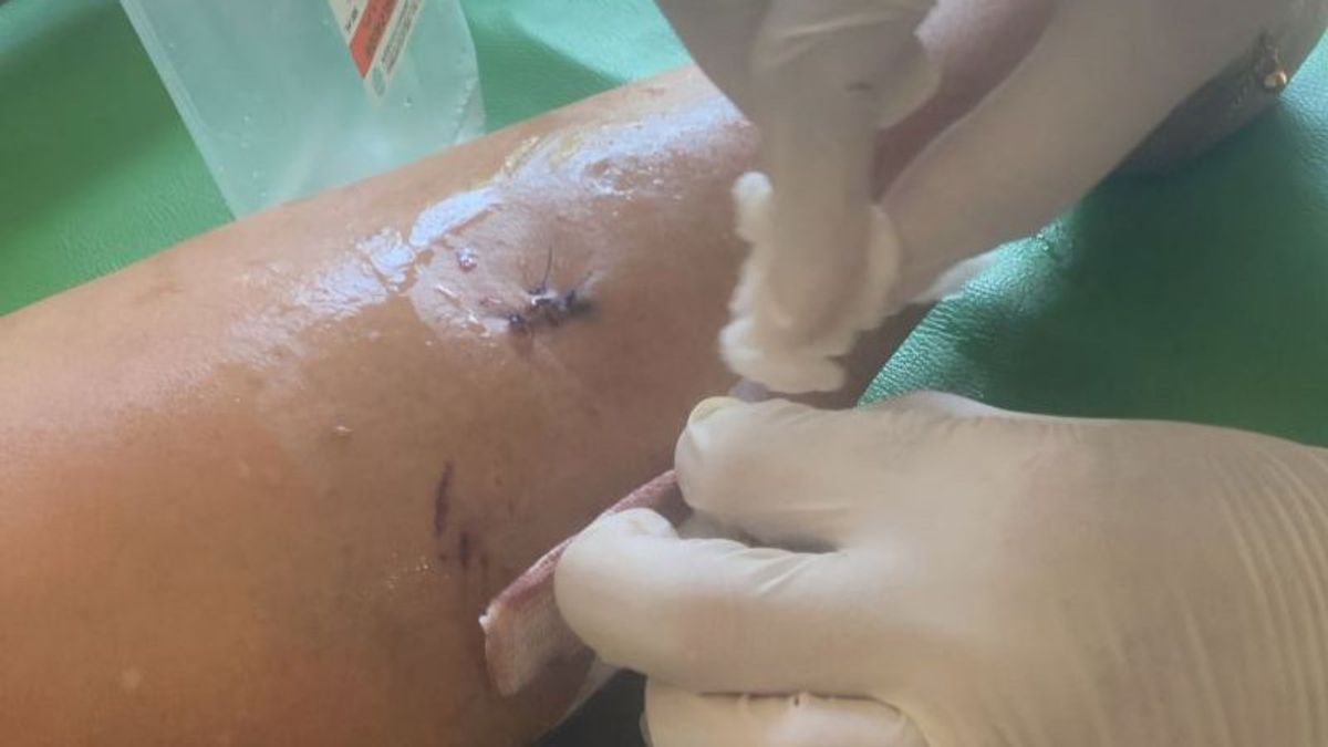 assis sur une moto en attendant des enfants, les personnes âgées à Tanjungpinang ont été attaquées par des chiens sauvages