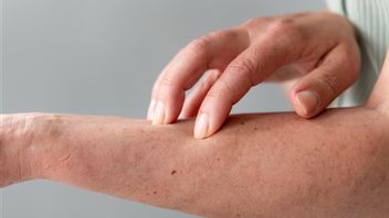 かゆみと急速に広がる、クレープを完全に克服する方法