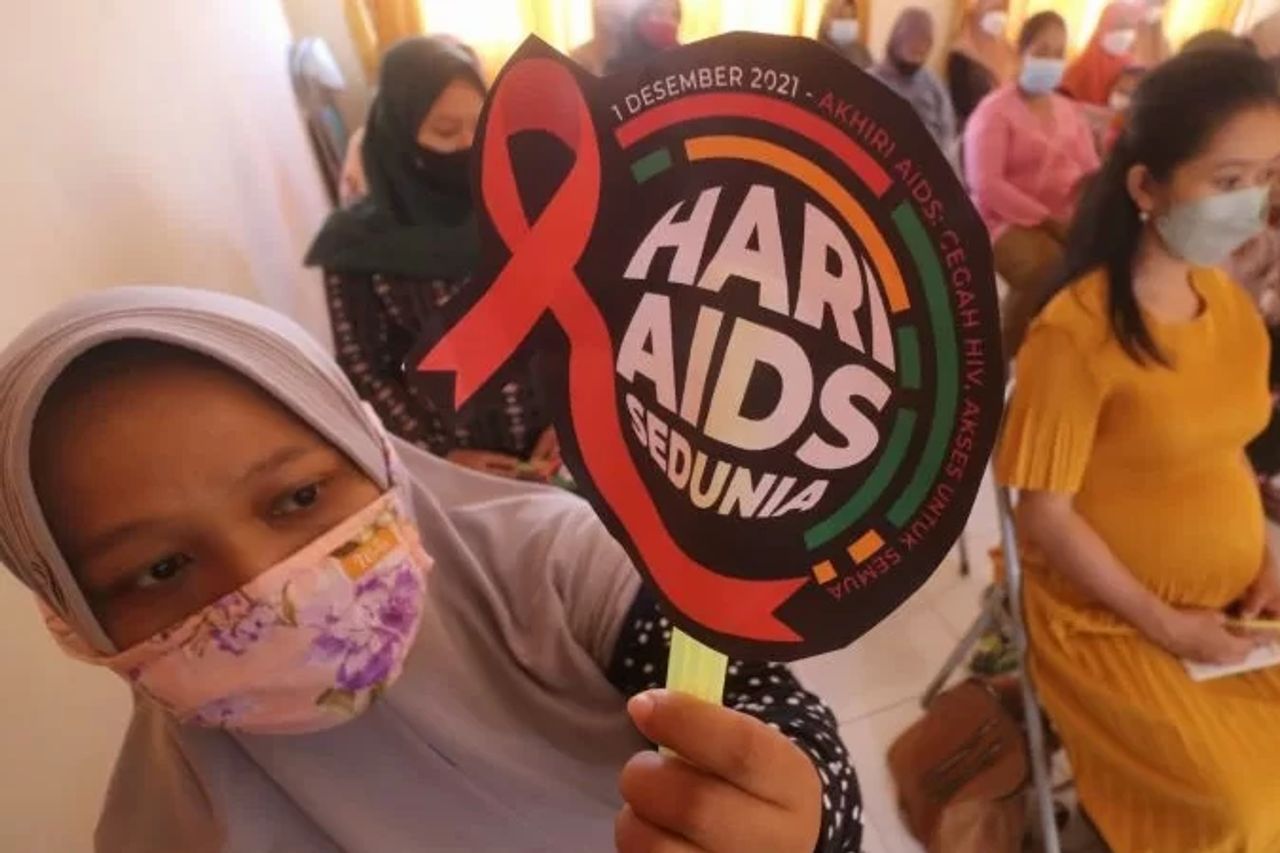 HIV患者のためのバンダルランプンオープン治療サービスの31の膿疱症