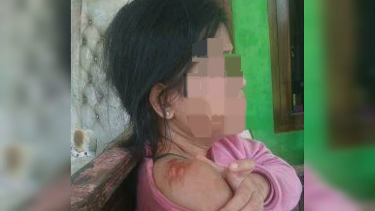 Woman Victim Of Domestic Violence In Bekasi Claims To Be Persecuted By Her Husband Since 2008, A Week After Getting Married Until Now