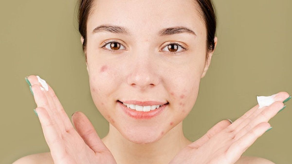 Sensitive Skin Owners Need To Be Careful In Choosing Acne Care Products