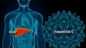 Kemenkes: WHO Minta Risiko Hepatitis Misterius Terus Diawasi