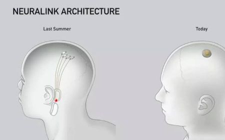 AS Tolak Rencana Uji Tanam Chip Elon Musk pada Otak Manusia