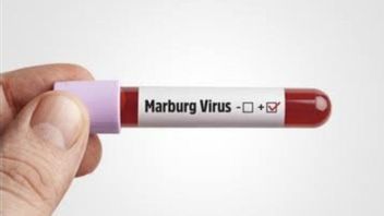 マールブルグウイルスの治療法とワクチンはありません、保健省は人々に警戒するように思い出させます