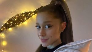 Hati-Hati, Gaya Rambut Ariana Grande Ini Picu Masalah Leher Serius