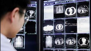 PANDA: AI Innovation For Cancer Detection From Alibaba Gets International Recognition