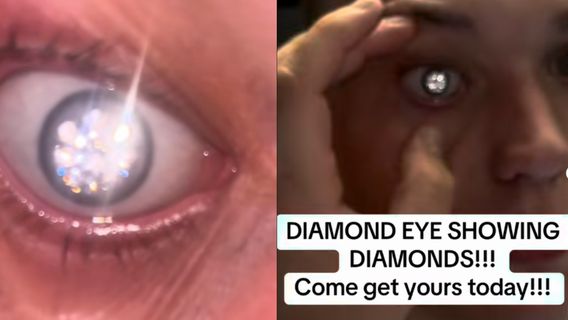 surprenant, un homme viral met des diamants de luxe dans les yeux