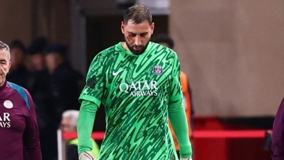 Donnarumma Horror Injury, Pul Sepatu In The Face