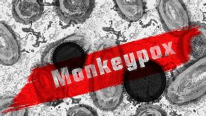 Satgas Monkeypox IDI Sebut Cacar Monyet Tak Bisa Menular Bila Pasien Belum Bergejala