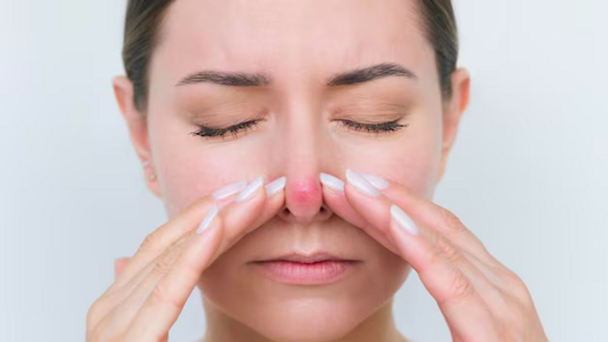 Ini Alasan Jerawat di Hidung Tak Boleh Sembarangan Dipencet