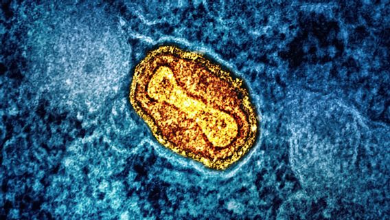 In Order To Prevent The Spread Of Mpox, The Entrance To The Republic Of Indonesia Must Be Tightened With Screening